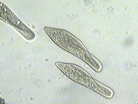 paramecium vs euglena under microscope